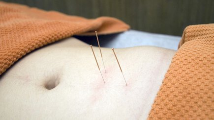 Akupunktur im Zentrum - Dr. Tan